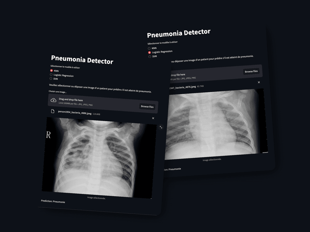 PneumonIA